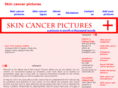 skincancerpictures.org