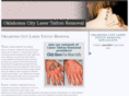 oklahomacitylasertattooremoval.com