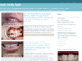 spotsonmyteeth.com