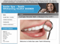teethbleachinguk.com