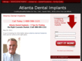 atlantadentalimplants.org