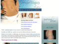 smartlipo-vaser-dallas.com