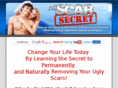 thescarsecret.com