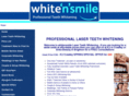 whitensmile.co.uk