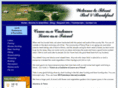 tibonisbandb.com