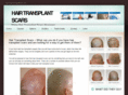 hairtransplantscars.com