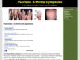 psoriaticarthritissymptoms.net