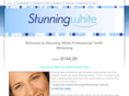 stunningwhite.net