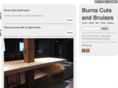 burnscutsandbruises.com