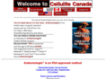 cellulitecanada.com