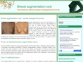 breast-augmentation-cost.info