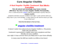 chelitis.com