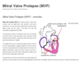 mitral-valve-prolapse.com