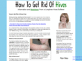 howtogetridofhives.net