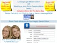 zoomteethwhiteningcalgary.com