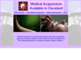 all-medical-acupuncture.com