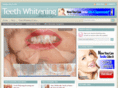 teethwhiteningadviser.com