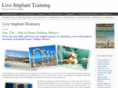 liveimplants.com