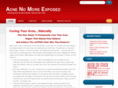 acnenomoreexposed.com