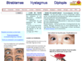 neuro-ophtalmologie.info
