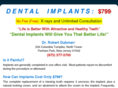 dentaldiscountimplants.com