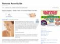 removeacneguide.org