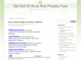 howtoacnetips.com
