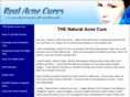 realacnecures.com