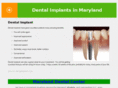 dentalimplantsmaryland.com