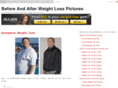 beforeandafterweightlosspictures.com
