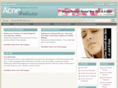 acneholistic.com
