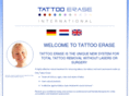 tattooerase.com