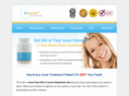 acnetox.com