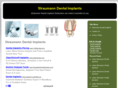 straumanndentalimplants.net