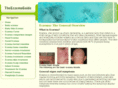 theeczemaguide.com