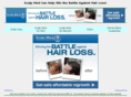 hair-loss-system.com