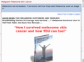 skin-cancer-melanoma.com
