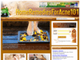 homeremediesforacne101.net