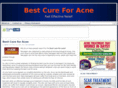 bestcureforacne.net