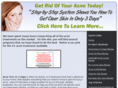 clearyouracnenaturally.com
