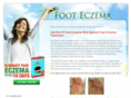 footeczema.net