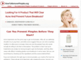 howtoremovepimples.org