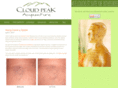 cloudpeakacupuncture.com