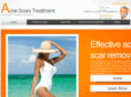 acnescars-westwood.com