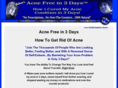 cureacne3days.com