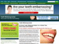 teethwhiteninginsider.com