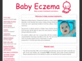 babyeczematreatments.com