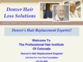 denverhairlosssolutions.com