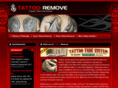 tattoo-remove.com