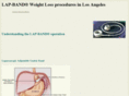 lapbandsurgerylosangeles.com